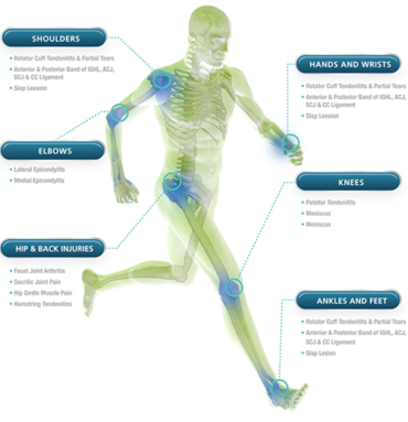 Injuries | Sports Medicine | Pain Management | PRP Treatment